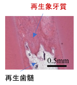 ②歯髄再生後の被蓋象牙質形成