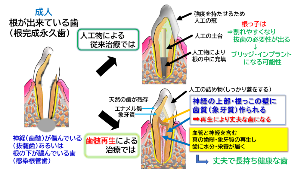 一般治療との違い・メリット（成人）