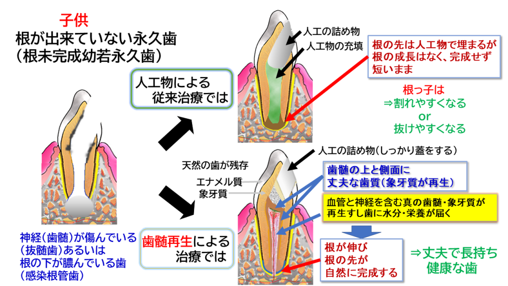 一般治療との違い・メリット（子供）